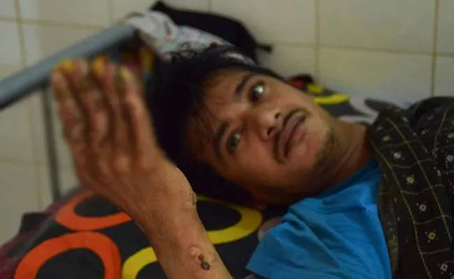 Bangladesh Tree Man Surgeries Failed - Sakshi