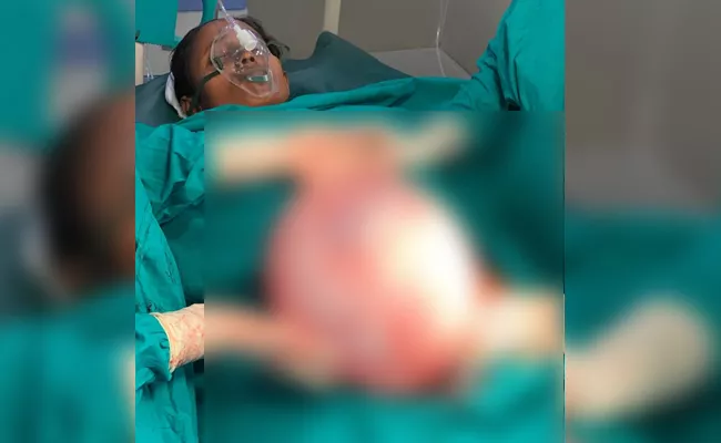Doctors Removed Seven Kgs Tumor in Women Stomach Guntur - Sakshi