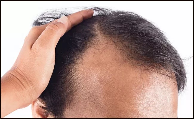 Bald Men More Vulnerable to Corona Virus - Sakshi