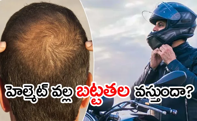 Wearing Helmet Is Connection With Hair Loss - Sakshi