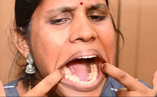 Indian Woman With 38 Teeth Sets Guinness World Record - Sakshi