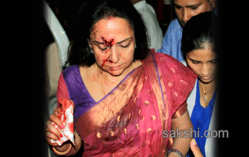 Hema Malini accident7