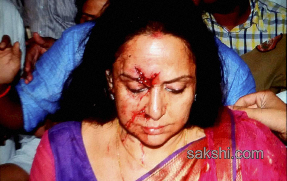 Hema Malini accident1