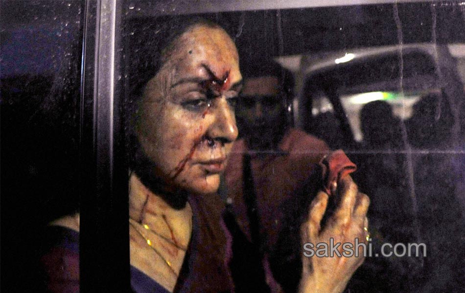 Hema Malini accident3