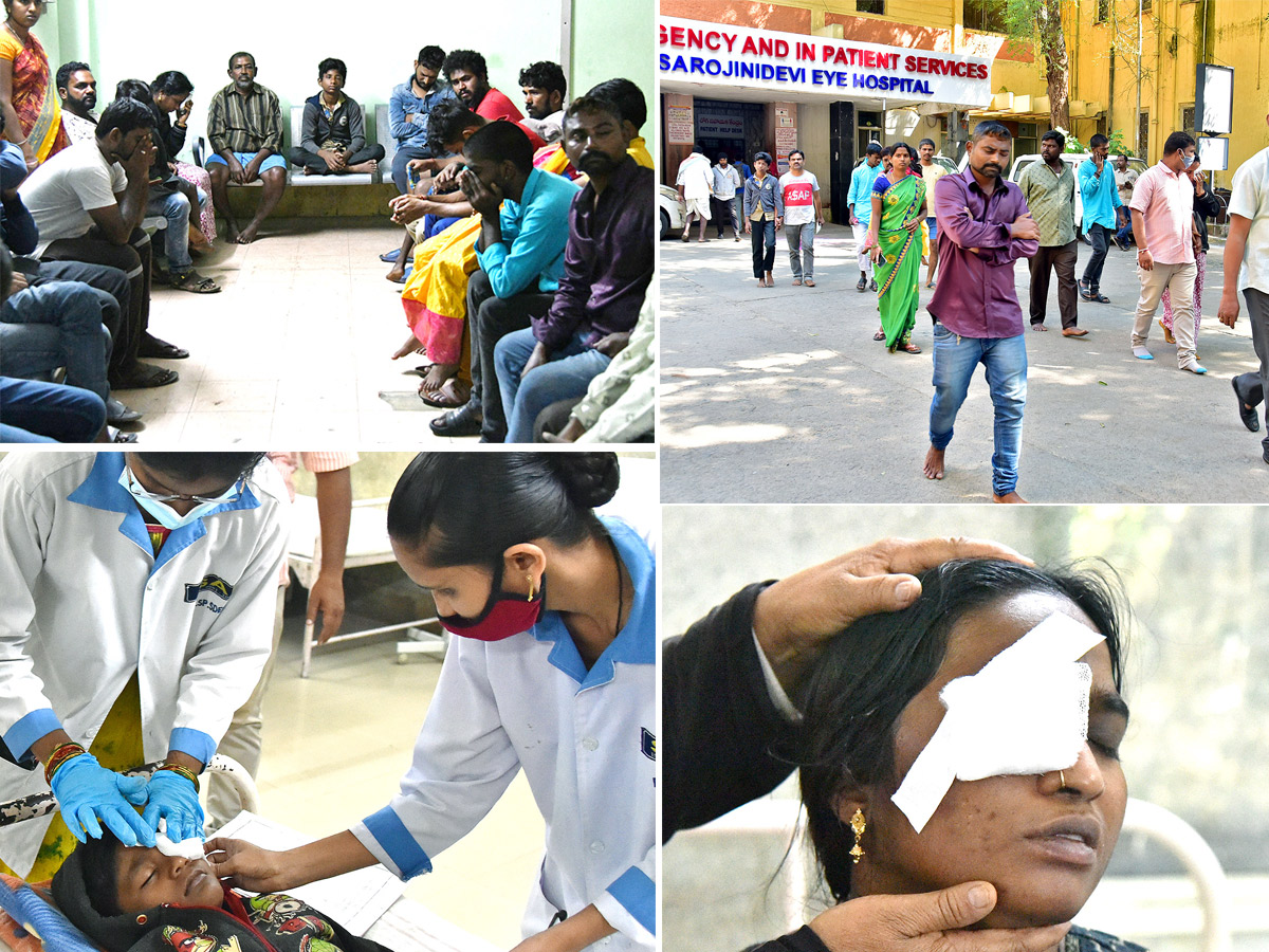 Hyderabad Sarojini Devi Hospital Many People Injured Diwali Crackers Burst - Sakshi1