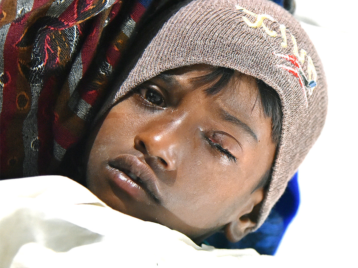 Hyderabad Sarojini Devi Hospital Many People Injured Diwali Crackers Burst - Sakshi12