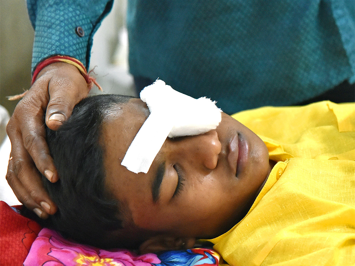 Hyderabad Sarojini Devi Hospital Many People Injured Diwali Crackers Burst - Sakshi7