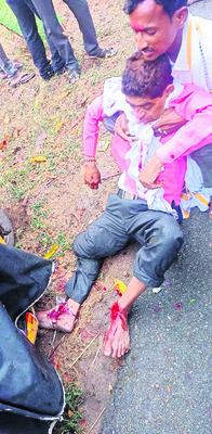 గాయపడ్డ మారుతి5