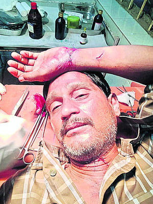 చికిత్స పొందుతున్న అచ్యుతరావు 1
