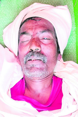 గుర్రాల వెంకటప్ప
మృతదేహం 2