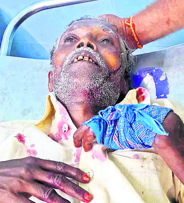 తీవ్రంగా గాయపడ్డ ముకుందరాజు, 
రామకృష్ణరాజు1