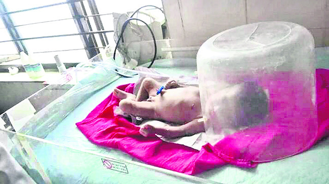 మృతి చెందిన శిశువు1