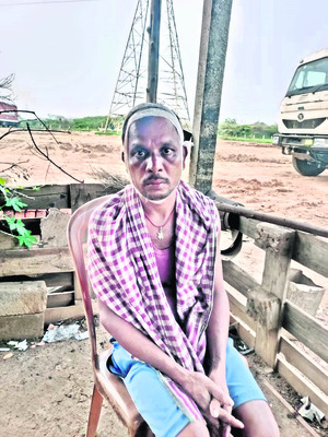 దాడిలో గాయపడిన
సర్వర్ ప్రదీప్
1