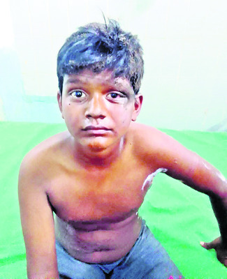 గాయపడిన దీక్షిత్1