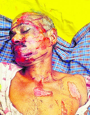 దూసుకొచ్చిన మృత్యువు 1