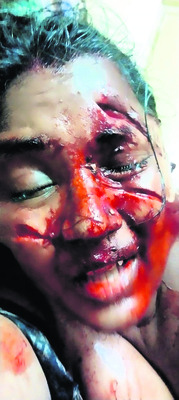 మహిళపై కత్తితో దాడి 1