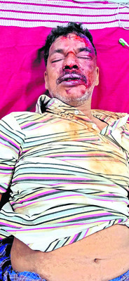 బైకు అదుపుతప్పి ఒకరి మృతి   2