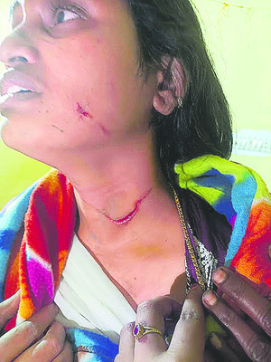 చిరుత దాడిలో దూడలు హతం
2