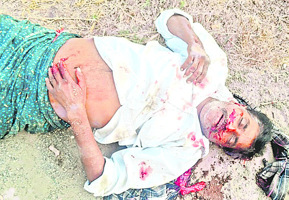 రోడ్డు ప్రమాదంలో   దంపతులకు తీవ్ర గాయాలు   1