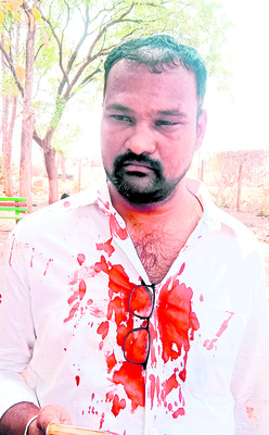 వైఎస్సార్‌సీపీ నాయకులపై దాడి1