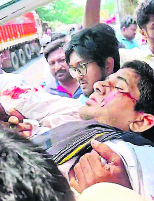 రోడ్డు ప్రమాదంలో భార్యాభర్తలకు తీవ్ర గాయాలు 1