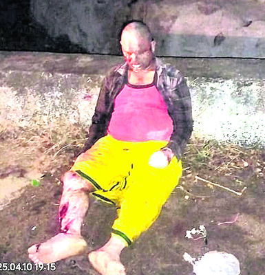 రోడ్డు ప్రమాదంలో ముగ్గురికి తీవ్రగాయాలు1