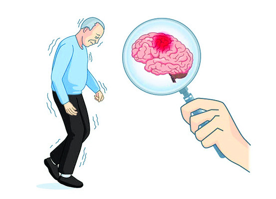 మందులతో నియంత్రణ 
1