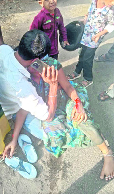 రోడ్డు ప్రమాదంలో మహిళకు గాయాలు1