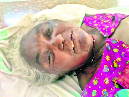 ఆటో ద్విచక్ర వాహనం ఢీ: ఇద్దరికి గాయాలు 2