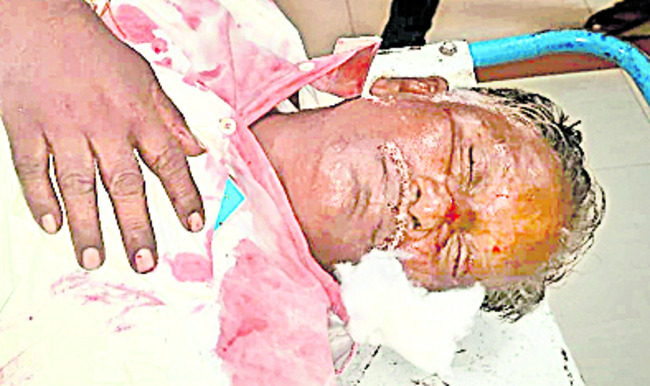 కుమార్తె పెళ్లికి వెళ్లి వస్తుండగా రోడ్డు ప్రమాదం 2