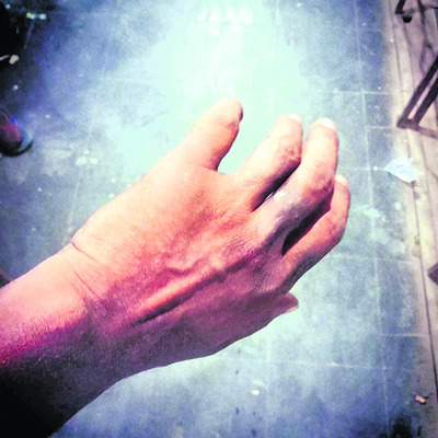 ఇంటికి పోతుండగా పోలీసులు కొట్టారు1