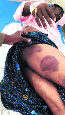 యువకుడిపై లాఠీ నృత్యం1