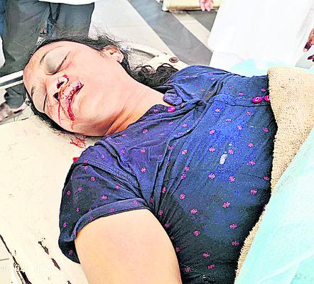 రోడ్డు ప్రమాదంలో మహిళ మృతి2