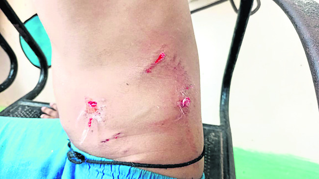 పిచ్చికుక్కల స్వైర విహారం 1