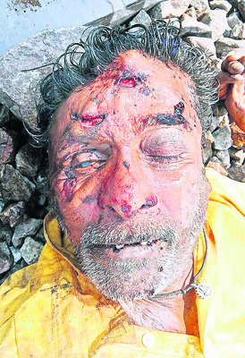 ఉపాధి వేతనదారుడు మృతి 1