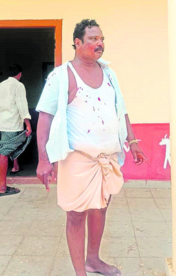 మాజీ ఎంపీటీసీ సభ్యుడిపై దాడి 1