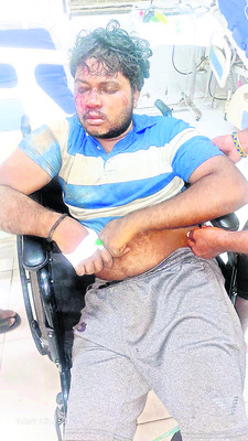 పాదయాత్ర భక్తులను ఢీకొట్టిన లారీ 1