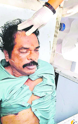 వికారాబాద్ జిల్లాలో ఘోర రోడ్డు ప్రమాదం 3