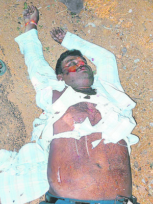 లారీ డ్రైవర్‌పై కేసు నమోదు  1