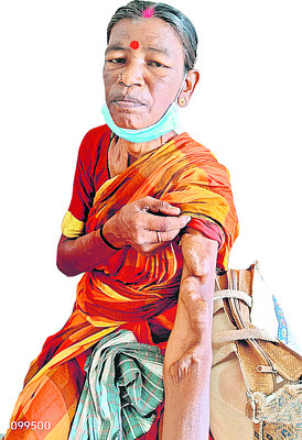 నా చేతిని చూస్తే భయపడతారు.. 1