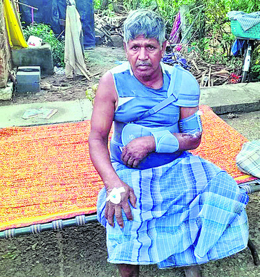 విద్యుత్‌ షార్ట్‌సర్క్యూట్‌తో వ్యక్తికి గాయాలు1