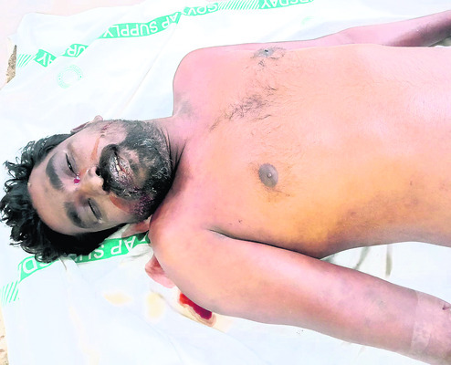 సమగ్ర సస్యరక్షణ చర్యలు పాటించాలి 2