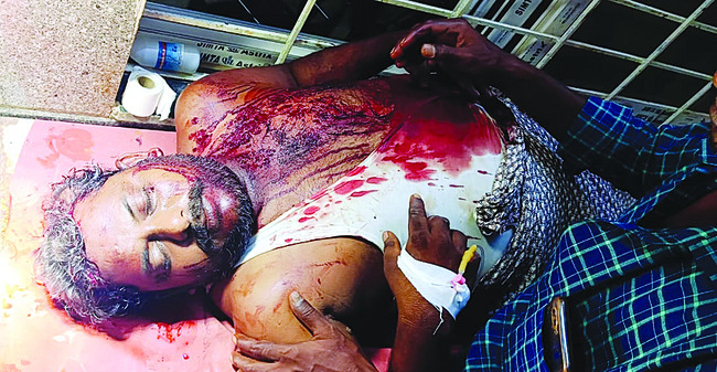 టీడీపీ నేతల పరస్పర దాడులు 1