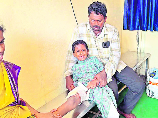 వాహనంలో రేడియేటర్ పేలి బాలికకు గాయాలు 1