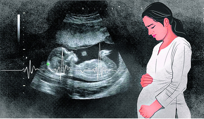 ఒక బిడ్డకు జన్మనివ్వాలన్నది ప్రతి సీ్త్ర కల. ఆ కలను సాక2