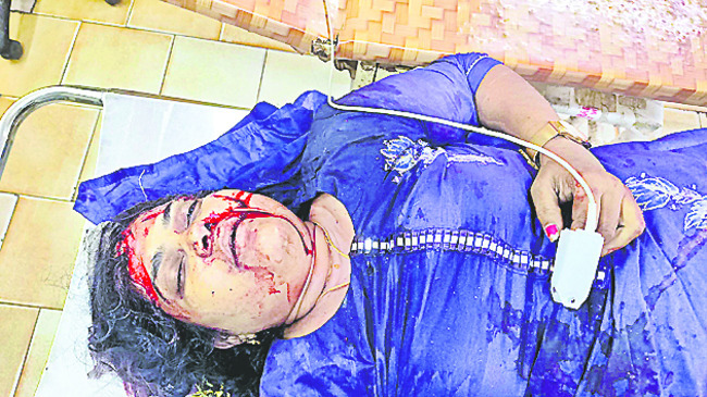 దైవ దర్శనానికి వెళ్లి వస్తుండగా ప్రమాదం1