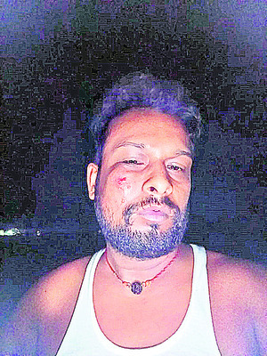 లారీ డ్రైవర్లపై దాడి 2