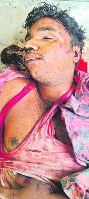 బాపట్ల5