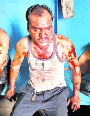 ఎన్టీపీసీ ప్లాంట్‌లో ప్రమాదం .. ఇద్దరు కార్మికులకు తీవ్1