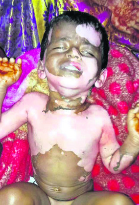 ధాన్యం లారీ బోల్తా: డ్రైవర్కు గాయాలు
1